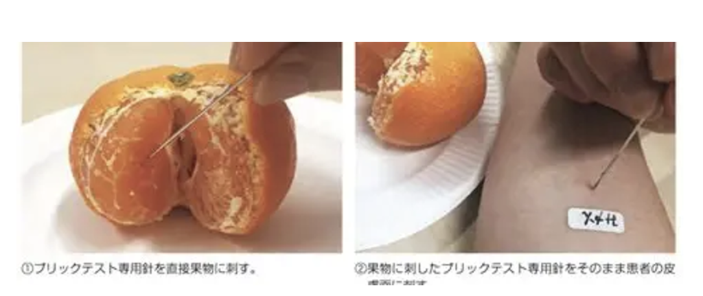 皮膚プリックテスト、プリック-プリックテスト